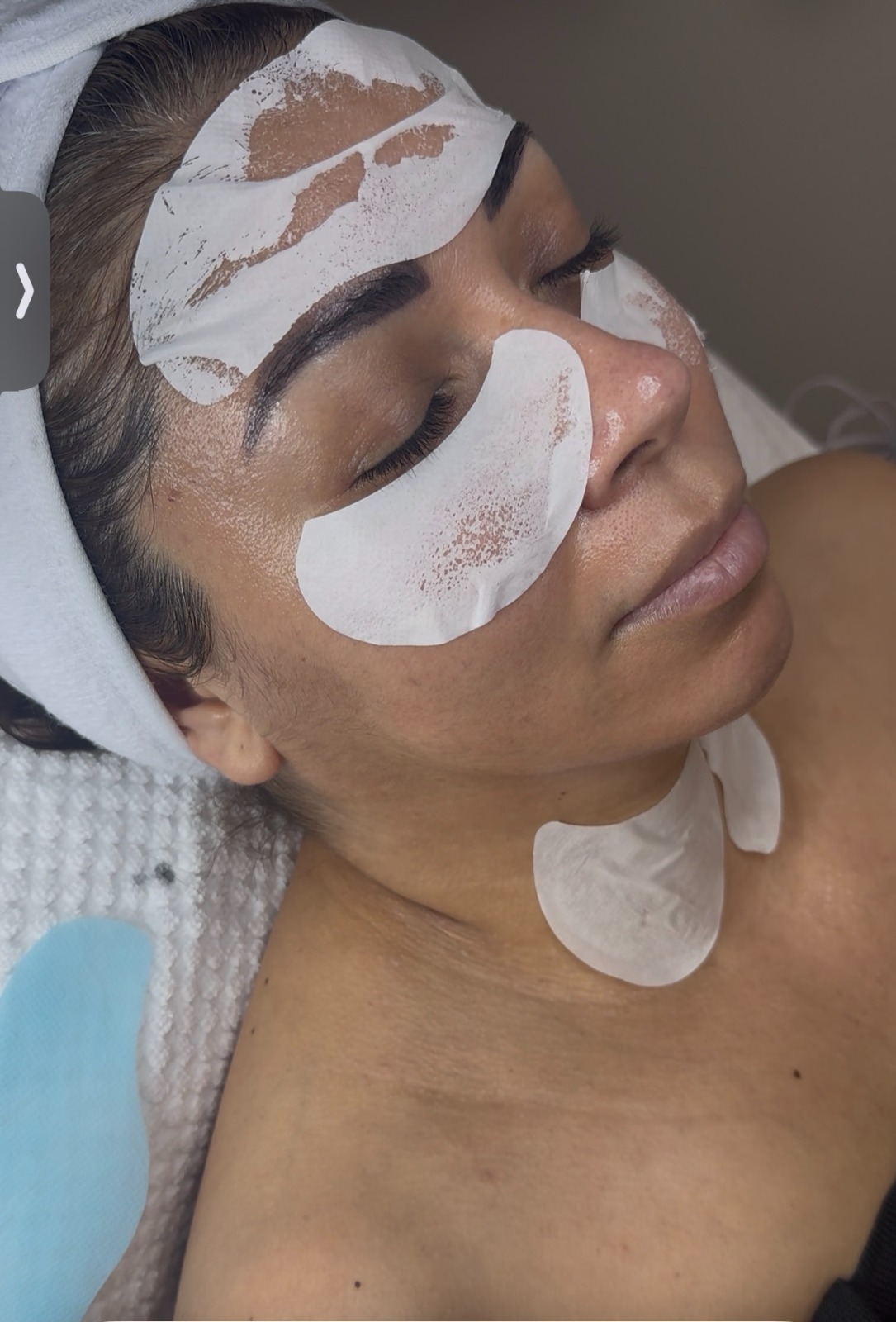 Glass Skin con Exosomas